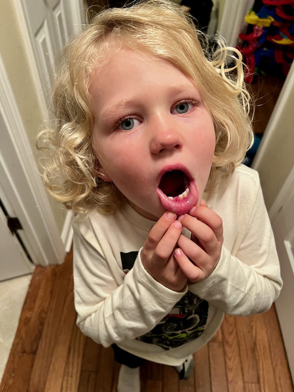 Desmond lost his first tooth! 🦷