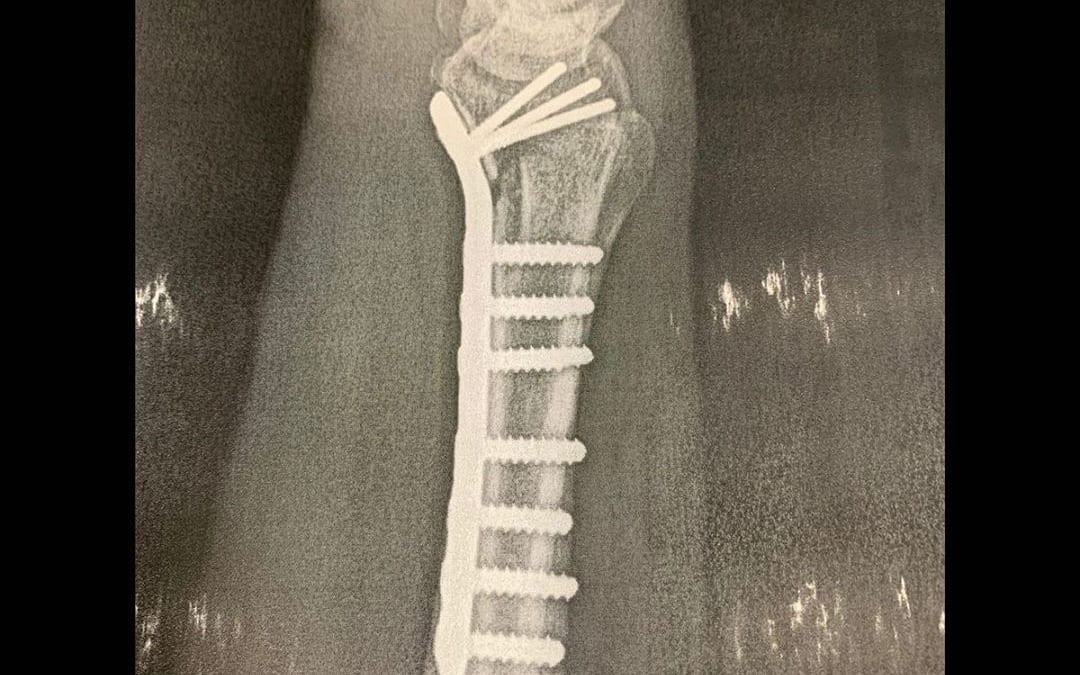 Mind you, this x-ray is the right arm of a pianist